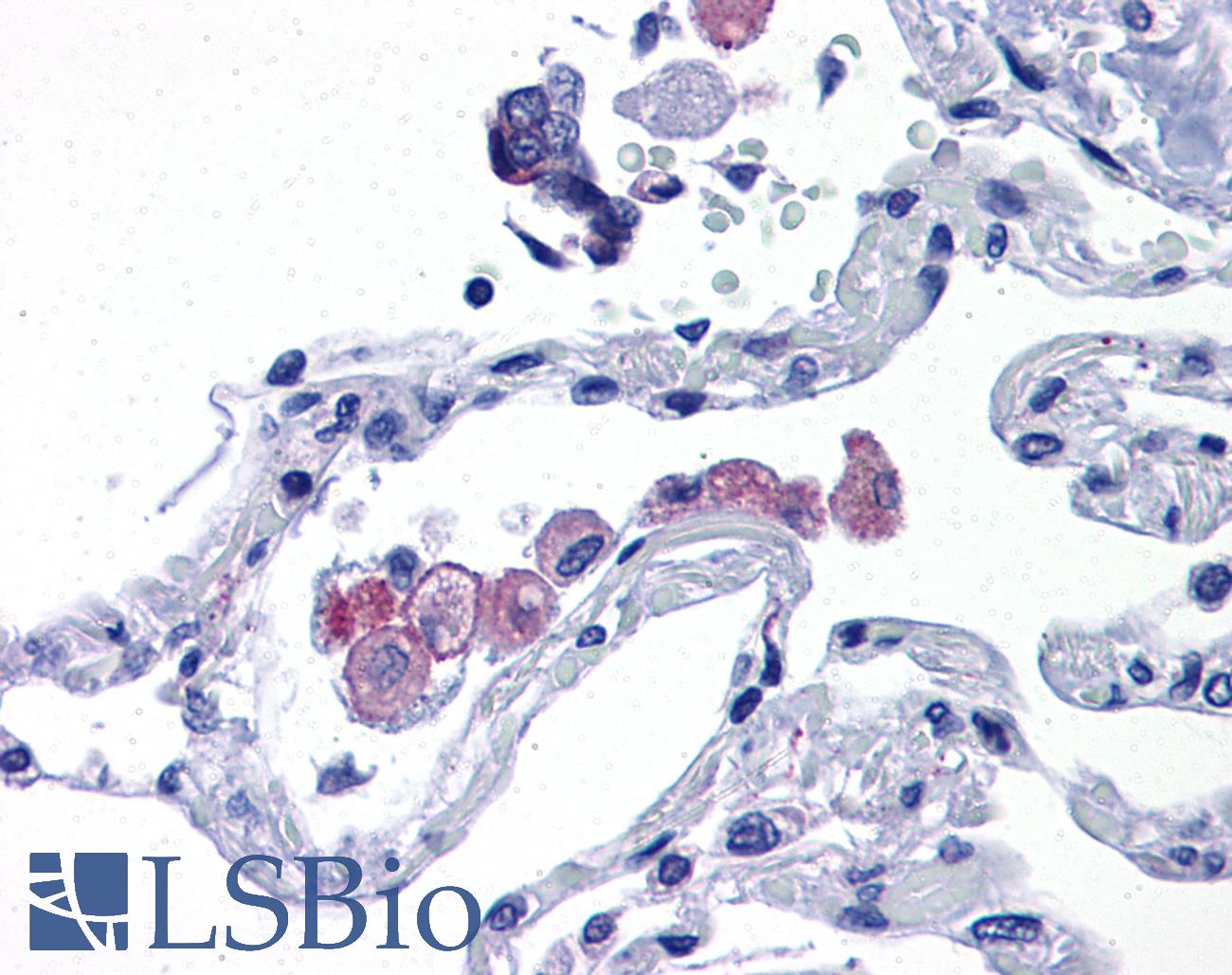 TLR7 / CD287 Antibody - Anti-TLR7 antibody IHC of human lung. Immunohistochemistry of formalin-fixed, paraffin-embedded tissue after heat-induced antigen retrieval. Antibody concentration 10 ug/ml.