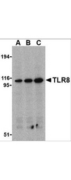 TLR8 Antibody - Western blot of Rabbit Anti-TLR8 Antibody. Lane 1: Daudi whole cell lysate primary antibody diluted to 1:2000. Lane 2: Daudi whole cell lysate primary antibody diluted to 1:1000. Lane 3: Daudi whole cell lysate primary antibody diluted to 1:500. Load: 10 ug per lane. Primary antibody: TLR 8 antibody overnight at 4C. Secondary antibody: IRDye800 rabbit secondary antibody at 1:10000 for 45 min at RT. Block: 5% BLOTTO overnight at 4C. Predicted/Observed size: 115 kDa, 115 kDa for TLR-8. Other band(s): none.