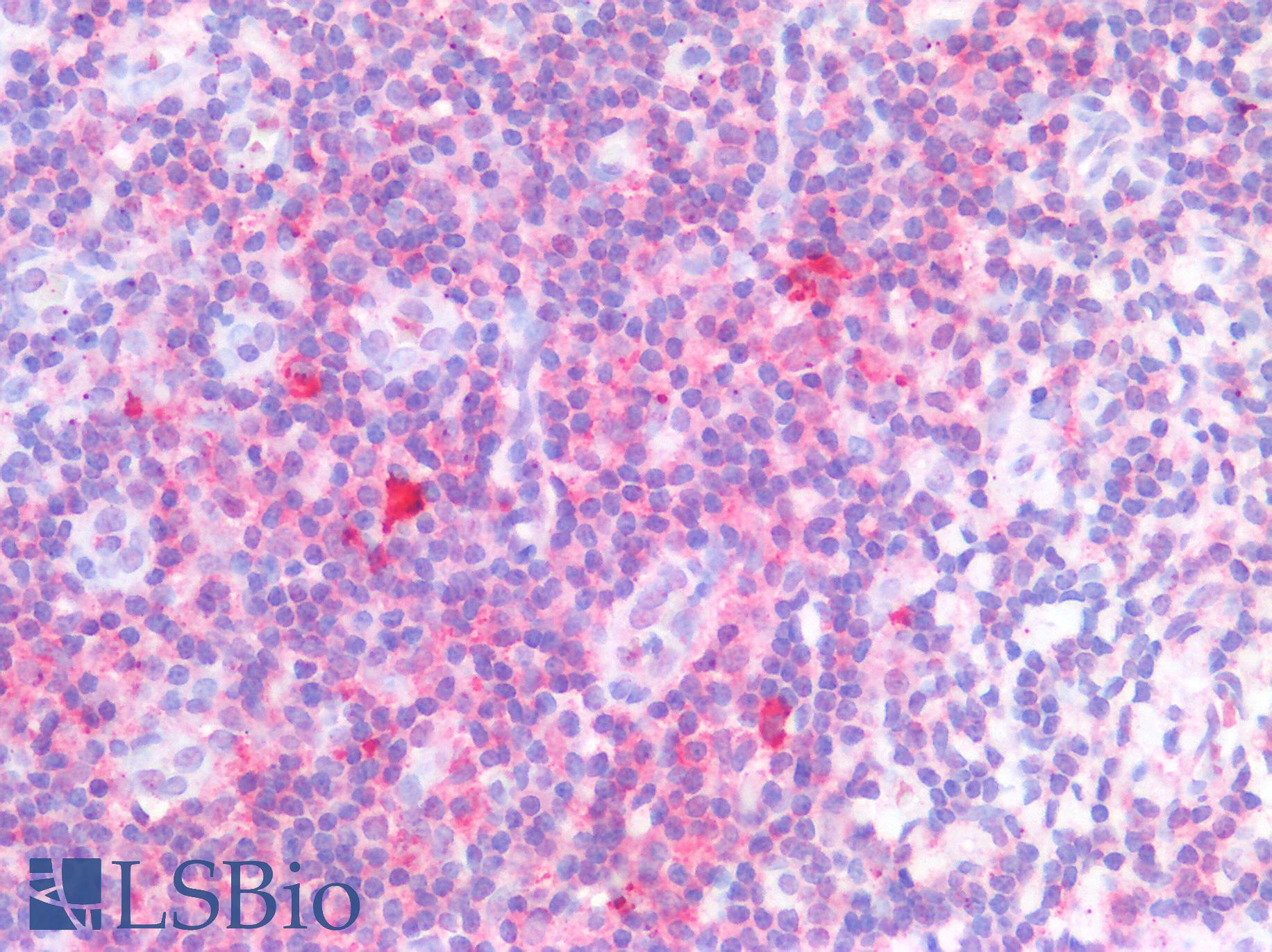 TLR8 Antibody - Human Tonsil: Formalin-Fixed, Paraffin-Embedded (FFPE)
