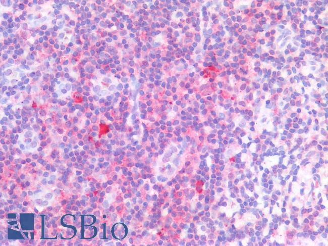 TLR8 Antibody - Human Tonsil: Formalin-Fixed, Paraffin-Embedded (FFPE)