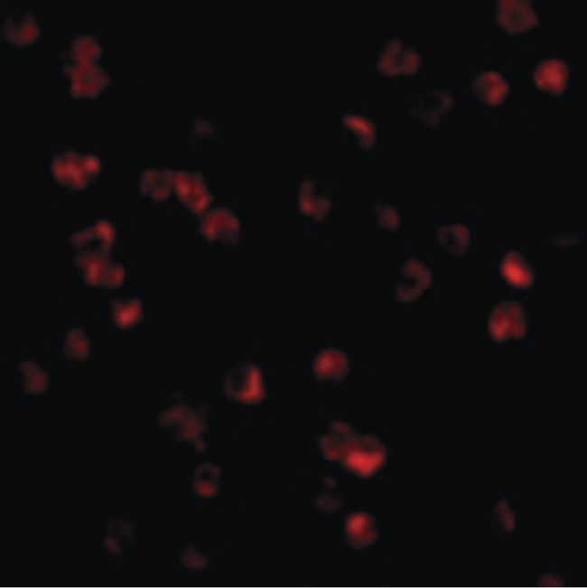 TLR8 Antibody - Immunofluorescence of TLR8 in Daudi cells with TLR8 antibody at 10 ug/ml.