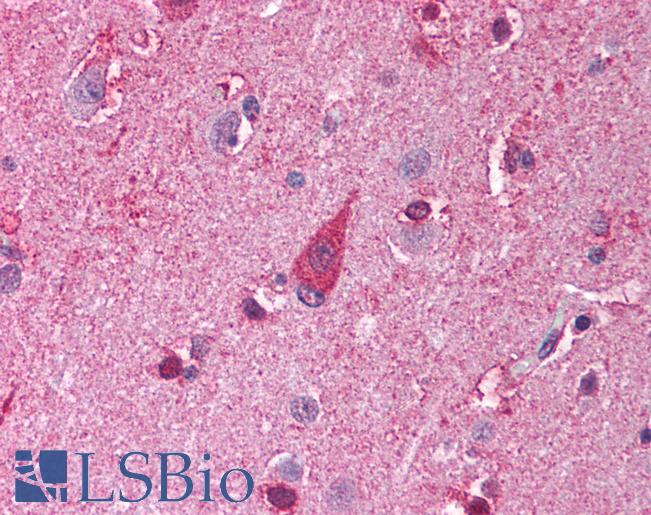 TLR8 Antibody - Anti-TLR8 antibody IHC of human brain, cortex. Immunohistochemistry of formalin-fixed, paraffin-embedded tissue after heat-induced antigen retrieval. Antibody concentration 5 ug/ml.