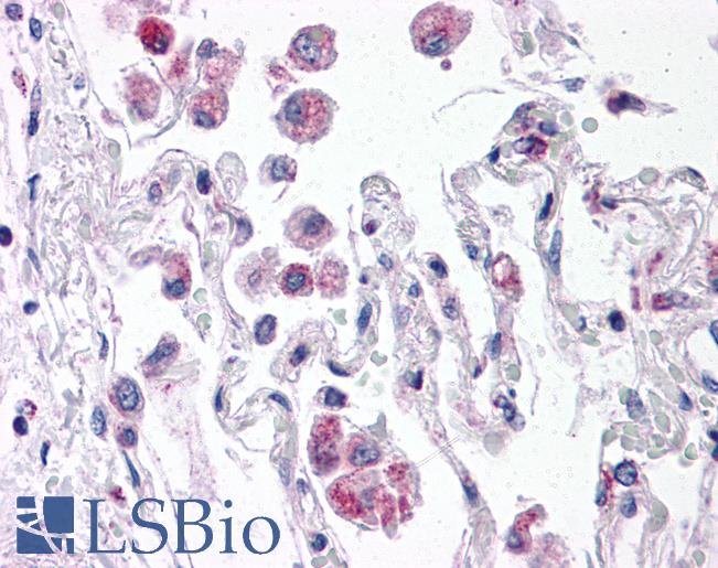 TLR8 Antibody - Anti-TLR8 antibody IHC of human lung. Immunohistochemistry of formalin-fixed, paraffin-embedded tissue after heat-induced antigen retrieval. Antibody concentration 5 ug/ml.