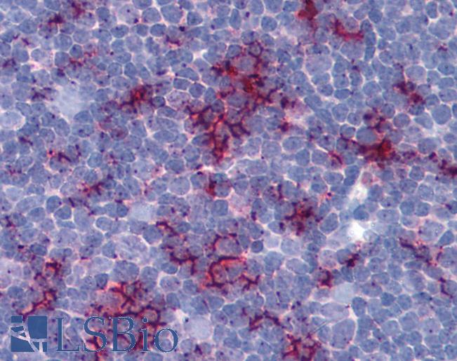 TLR8 Antibody - Anti-TLR8 antibody IHC of human thymus. Immunohistochemistry of formalin-fixed, paraffin-embedded tissue after heat-induced antigen retrieval. Antibody concentration 5 ug/ml.