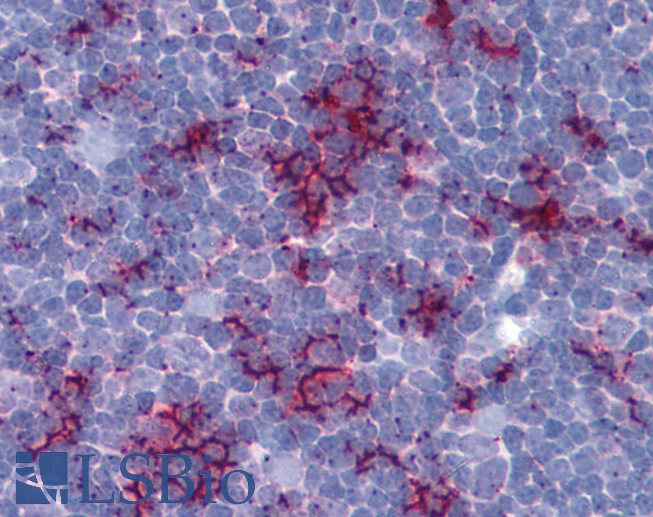 TLR8 Antibody - Anti-TLR8 antibody IHC of human thymus. Immunohistochemistry of formalin-fixed, paraffin-embedded tissue after heat-induced antigen retrieval. Antibody concentration 5 ug/ml.