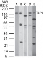 TLR9 Antibody - Western blot of TLR9 in A) human PBMC, B) human intestine, C) mouse intestine, and D) rat intestine tissue lysates using antibody at a dilution of 3 ug/ml. Lane E shows antibody tested at 5 ug/ml in human MCF7 cell lysate.