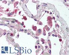 TLR9 Antibody - Anti-TLR9 antibody IHC of human lung. Immunohistochemistry of formalin-fixed, paraffin-embedded tissue after heat-induced antigen retrieval. Antibody concentration 5 ug/ml.