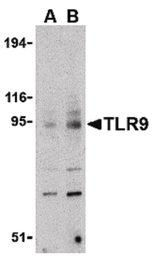TLR9 Antibody - Western blot of TLR9 in mouse spleen cell lysate with TLR9 antibody at (A) 0.5, (B) 1 and (C) 2 ug/ml.