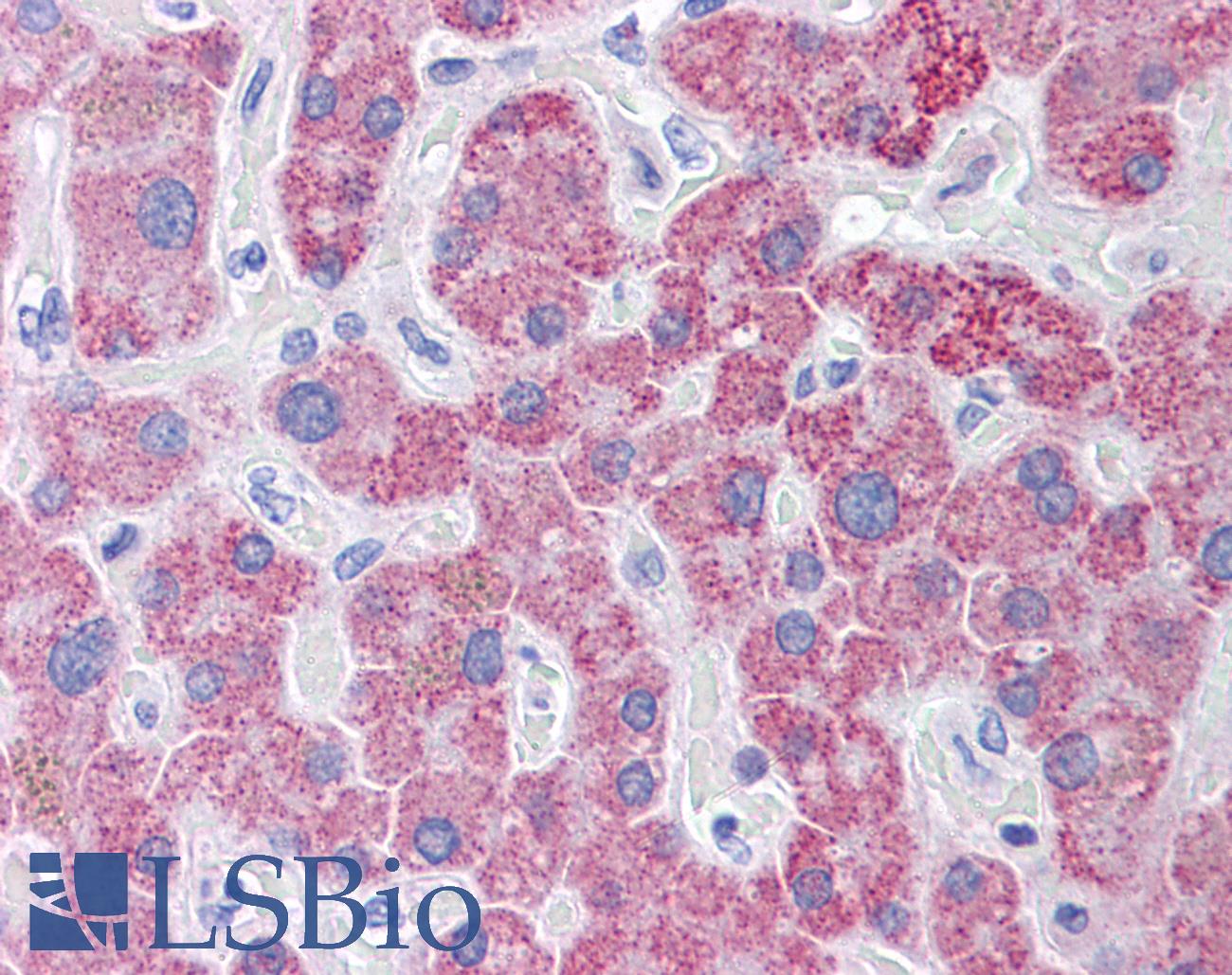 TLR9 Antibody - Anti-TLR9 antibody IHC of human liver. Immunohistochemistry of formalin-fixed, paraffin-embedded tissue after heat-induced antigen retrieval. Antibody concentration 5 ug/ml.