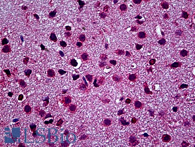 TLR9 Antibody - Anti-TLR9 antibody IHC of mouse brain. Immunohistochemistry of formalin-fixed, paraffin-embedded tissue after heat-induced antigen retrieval. Antibody concentration 2.5 ug/ml.