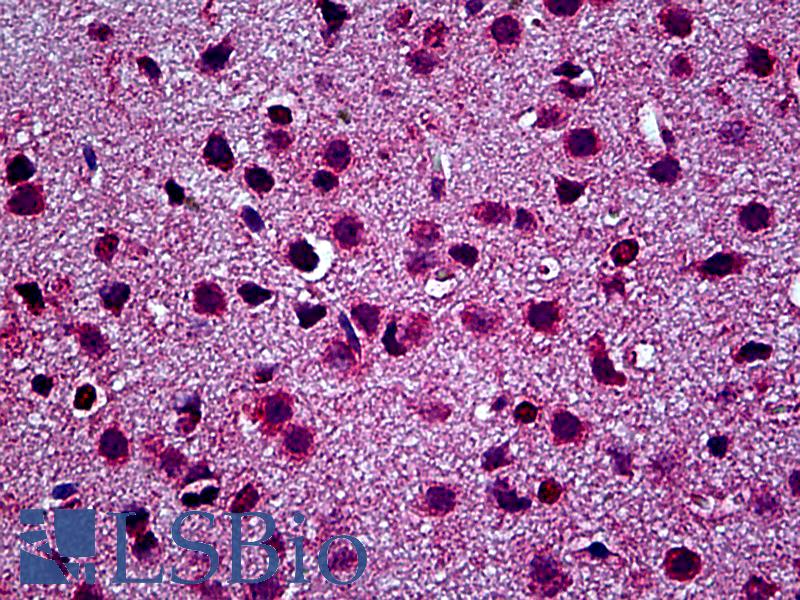 TLR9 Antibody - Anti-TLR9 antibody IHC of mouse brain. Immunohistochemistry of formalin-fixed, paraffin-embedded tissue after heat-induced antigen retrieval. Antibody concentration 2.5 ug/ml.