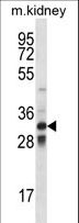 TLX1 / HOX11 Antibody - TLX1 Antibody western blot of mouse kidney tissue lysates (35 ug/lane). The TLX1 antibody detected the TLX1 protein (arrow).