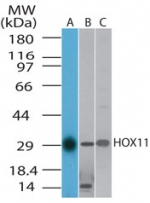 TLX1 / HOX11 Antibody - Western blot of HOX11 in A) human, B) mouse and C) ratuliver cell lysate using antibody at 1 ug/ml.