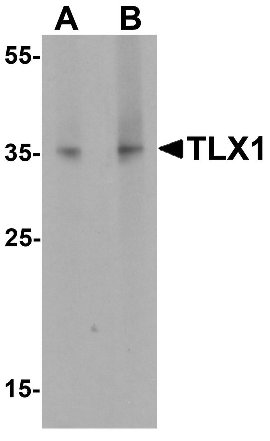 TLX1 / HOX11 Antibody - Western blot analysis of TLX1 in mouse spleen tissue lysate with TLX1 antibody at (A) 1 ug/ml and (B) 2 ug/ml.