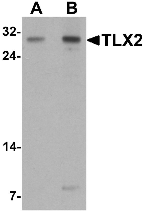 TLX2 / NCX Antibody - Western blot analysis of TLX2 in rat brain tissue lysate with TLX2 antibody at (A) 0.5 and (B) 1 ug/ml.
