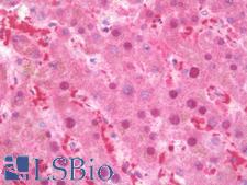 TLX2 / NCX Antibody - Anti-TLX2 / NCX antibody IHC staining of human liver. Immunohistochemistry of formalin-fixed, paraffin-embedded tissue after heat-induced antigen retrieval. Antibody concentration 10 ug/ml.