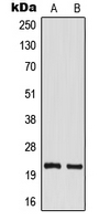 TM2D1 / BBP Antibody - Western blot analysis of TM2D1 expression in MCF7 (A); mouse kidney (B) whole cell lysates.