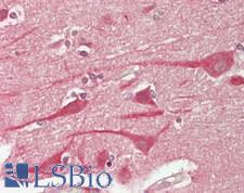 TM2D1 / BBP Antibody - Human Brain, Cortex: Formalin-Fixed, Paraffin-Embedded (FFPE)