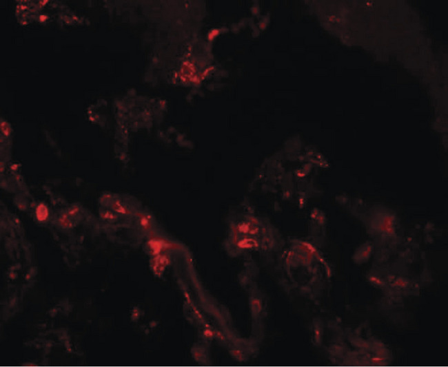 TM4SF1 Antibody - Immunofluorescence of TM4SF1 in human lung tissue with TM4SF1 antibody at 20 ug/ml.