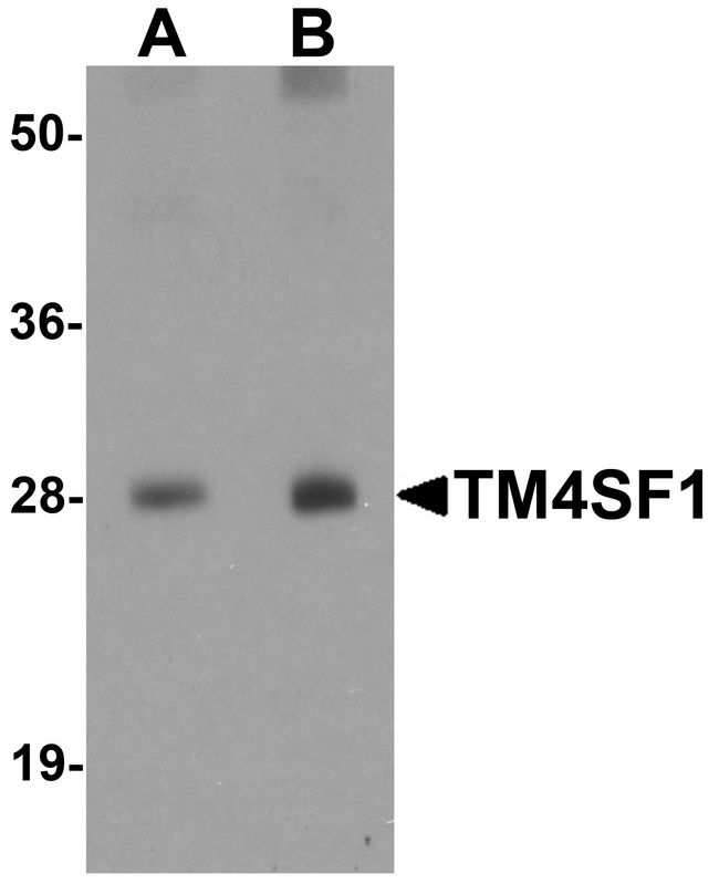 TM4SF1 Antibody - Western blot analysis of TM4SF1 in human lung tissue lysate with TM4SF1 antibody at (A) 0.5 and (B) 1 ug/ml.