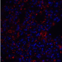 TM4SF1 Antibody - Immunofluorescence of TM4SF1 in mouse lung tissue with TM4SF1 antibody at 20 µg/mL.