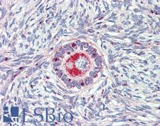 TM9SF1 Antibody - Anti-TM9SF1 antibody IHC of human ovary. Immunohistochemistry of formalin-fixed, paraffin-embedded tissue after heat-induced antigen retrieval.
