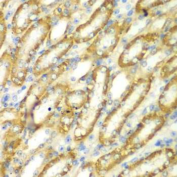 TM9SF1 Antibody - Immunohistochemistry of paraffin-embedded mouse kidney tissue.