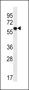 TM9SF2 Antibody - TM9SF2 Antibody western blot of U251 cell line lysates (35 ug/lane). The TM9SF2 antibody detected the TM9SF2 protein (arrow).