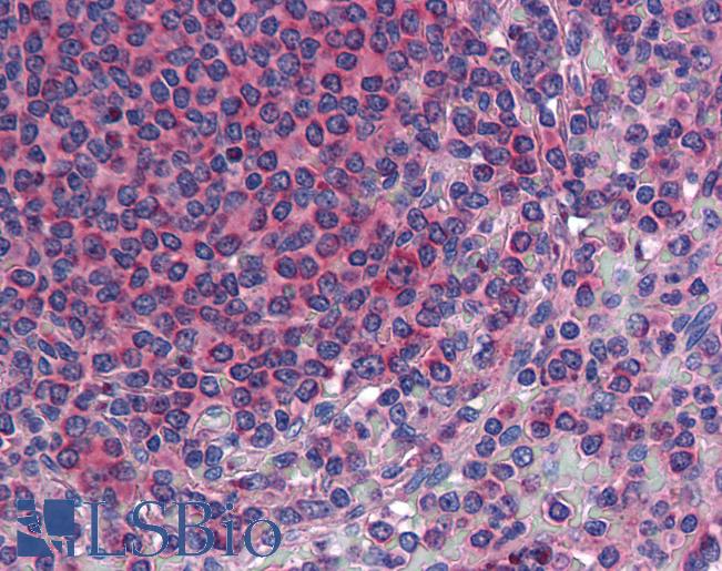 TM9SF3 Antibody - Anti-TM9SF3 antibody IHC of human spleen. Immunohistochemistry of formalin-fixed, paraffin-embedded tissue after heat-induced antigen retrieval.