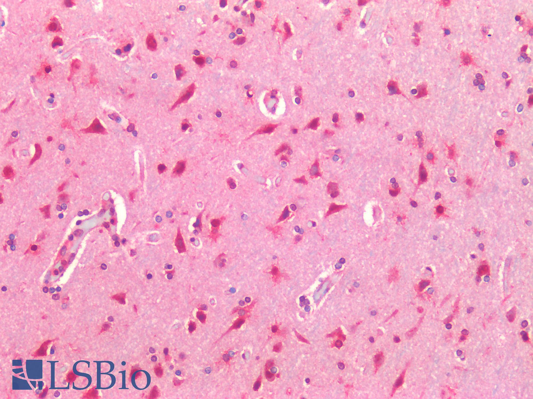 TM9SF4 Antibody - Human Brain, Cortex: Formalin-Fixed, Paraffin-Embedded (FFPE)