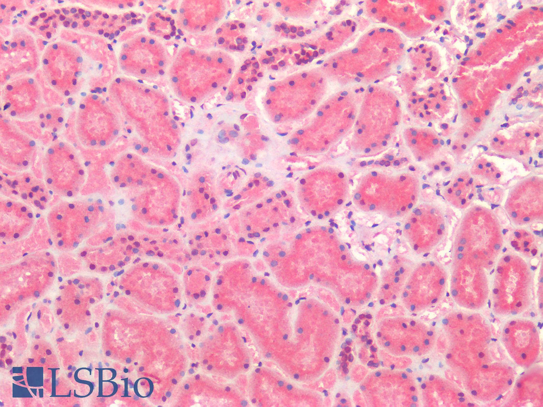 TM9SF4 Antibody - Human Kidney: Formalin-Fixed, Paraffin-Embedded (FFPE)
