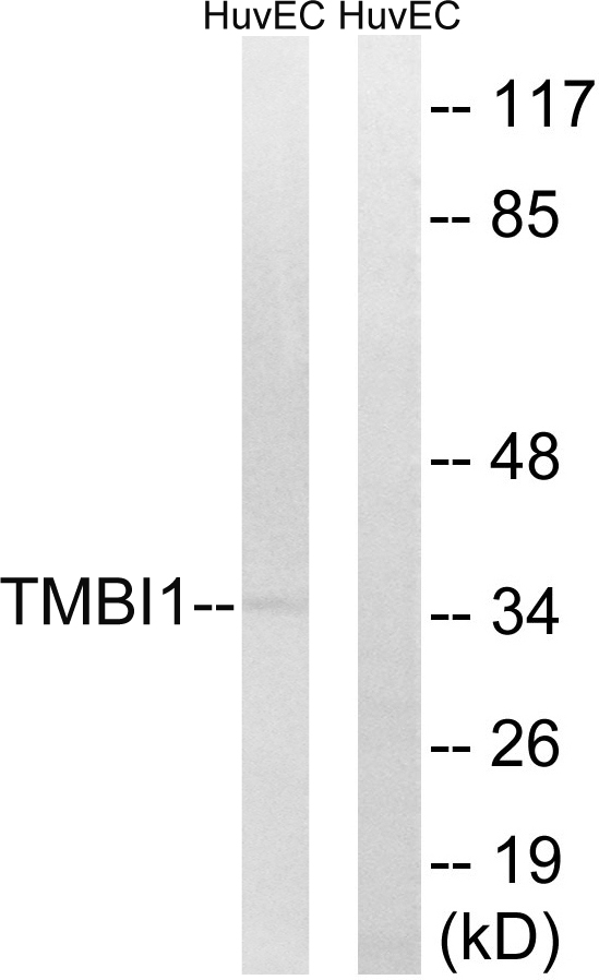 TMBIM1 Antibody - Western blot analysis of lysates from HUVEC cells, using TMBIM1 Antibody. The lane on the right is blocked with the synthesized peptide.