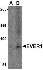 TMC6 Antibody - Western blot of EVER1 in A-20 cell lysate with EVER1 antibody at (A) 1 and (B) 2 ug/ml.
