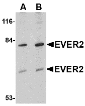 TMC8 / EVER2 Antibody - Western blot of EVER2 in Jurkat cell lysate with EVER2 antibody at (A) 1 and (B) 2 ug/ml.