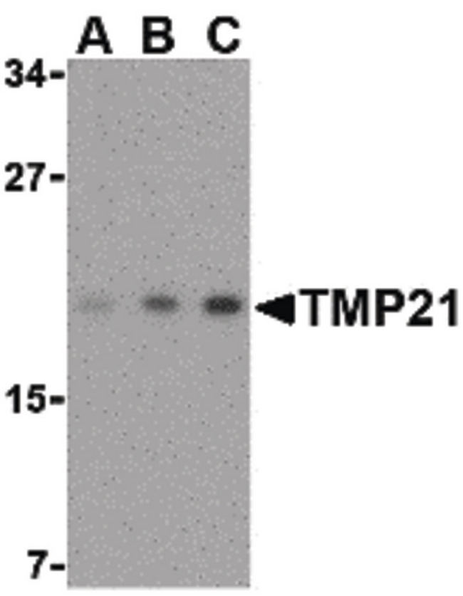 TMED10 / TMP21 Antibody - Western blot of TMP21 in mouse brain tissue lysate with TMP21 antibody at (A) 0.5, (B) 1 and (C) 2 ug/ml.