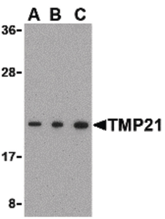 TMED10 / TMP21 Antibody - Western blot of TMP21 in Raji cell lysate with TMP21 antibody at (A) 0.5 and (B) 1 and (C) 2 ug/ml.