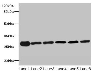 TMED9 Antibody - Western blot All lanes: TMED9 antibody at 4.5µg/ml Lane 1: Mouse liver tissue Lane 2: Mouse kidney tissue Lane 3: Human placenta tissue Lane 4: A549 whole cell lysate Lane 5: MCF-7 whole cell lysate Lane 6: A431 whole cell lysate Secondary Goat polyclonal to rabbit IgG at 1/10000 dilution Predicted band size: 27 kDa Observed band size: 27 kDa