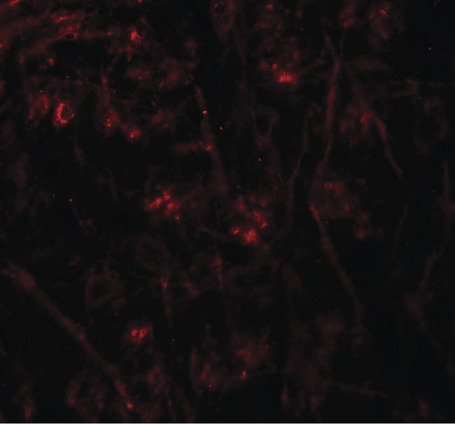 TMEM106A Antibody - Immunofluorescence of TMEM106A in mouse brain tissue with TMEM106A antibody at 20 ug/ml.