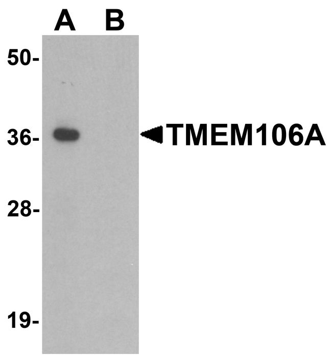 TMEM106A Antibody - Western blot analysis of TMEM106A in A-20 cell lysate with TMEM106A antibody at 1 ug/ml in (A) the absence and (B) the presence of blocking peptide.