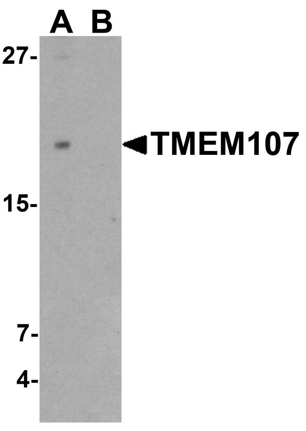 TMEM107 Antibody - Western blot analysis of TMEM107 in THP-1 cell lysate with TMEM107 antibody at 1 ug/ml in (A) the absence and (B) the presence of blocking peptide.