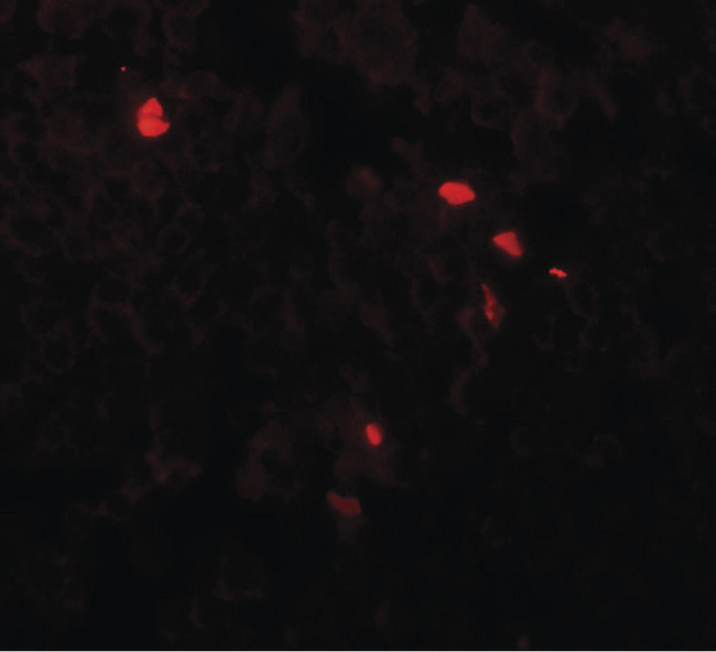 TMEM107 Antibody - Immunofluorescence of TMEM107 in human lymph node tissue with TMEM107 antibody at 20 ug/ml.