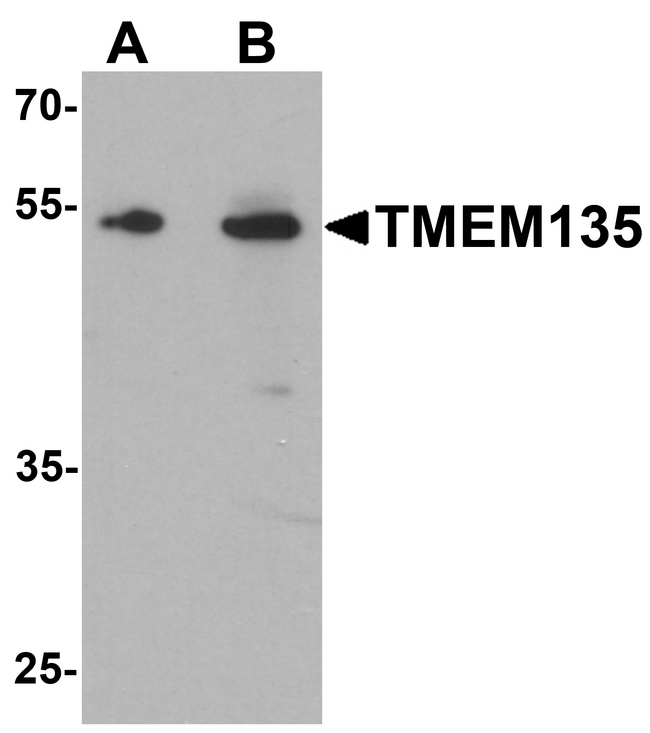 TMEM135 Antibody - Western blot analysis of TMEM135 in rat liver tissue lysate with TMEM135 antibody at (A) 1 and (B) 2 ug/ml.
