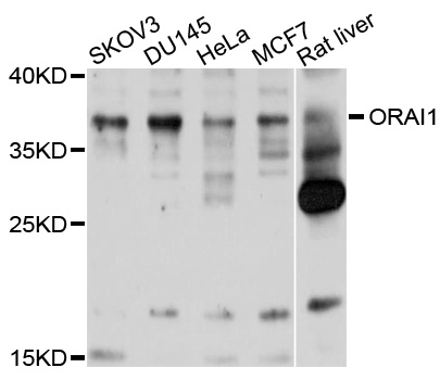 TMEM142A / ORAI1 Antibody - Western blot analysis using ORAI1 antibody.