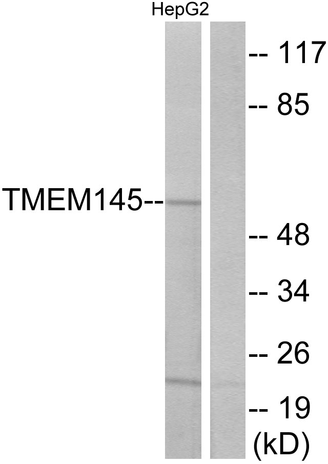 TMEM145 Antibody - Western blot analysis of lysates from HepG2 cells, using TMEM145 Antibody. The lane on the right is blocked with the synthesized peptide.