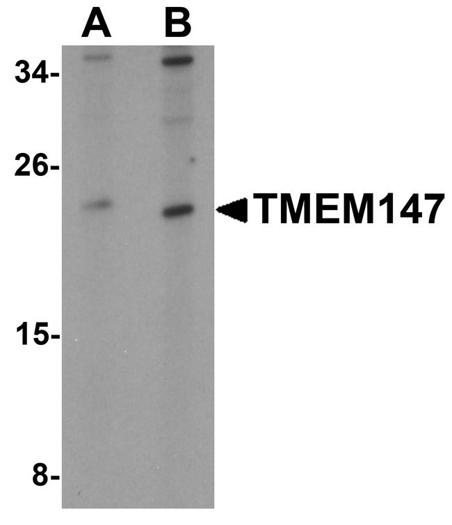 TMEM147 Antibody - Western blot analysis of TMEM147 in Daudi cell lysate with TMEM147 antibody at (A) 1 and (B) 2 ug/ml.
