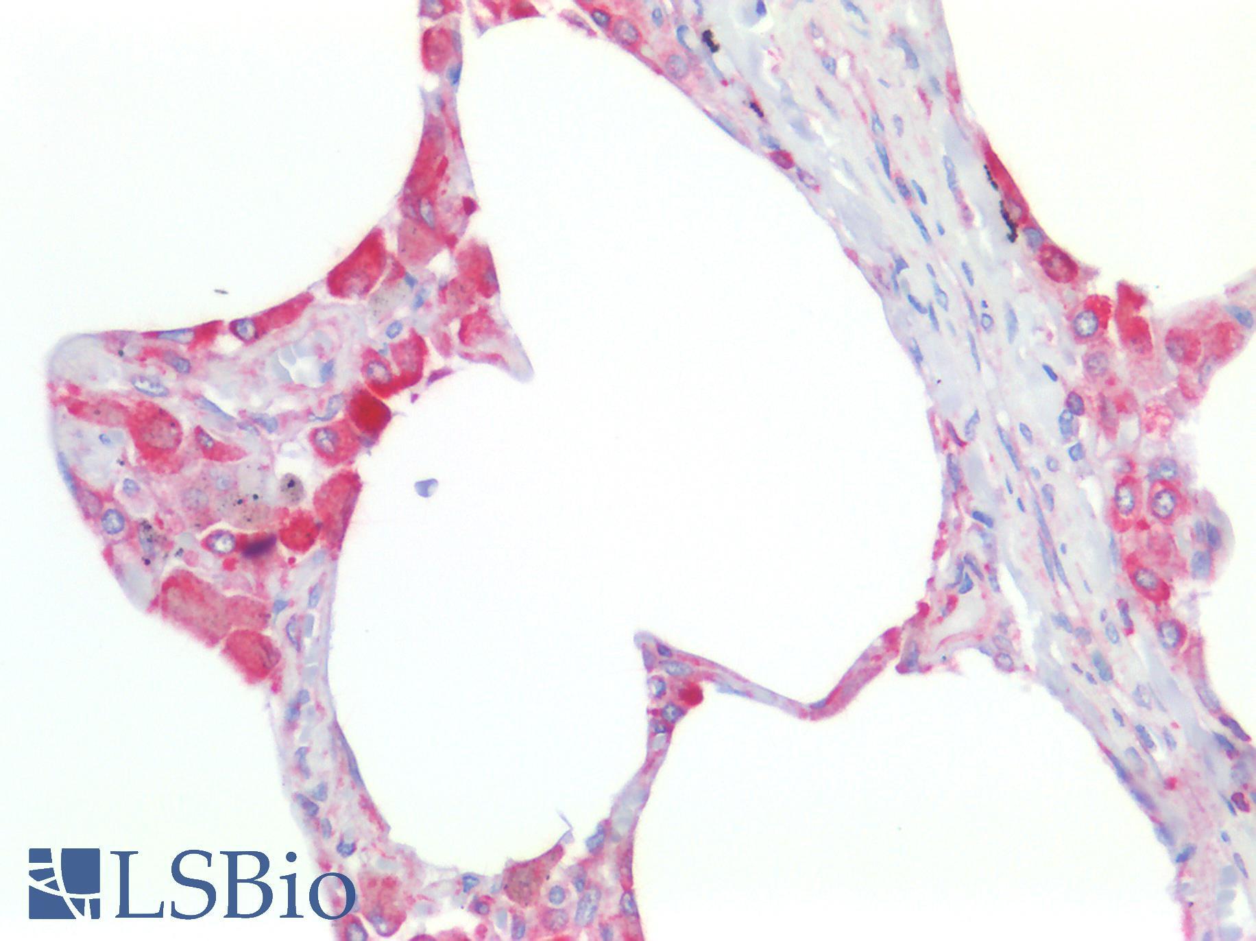 TMEM173 / STING Antibody - Human Lung: Formalin-Fixed, Paraffin-Embedded (FFPE)