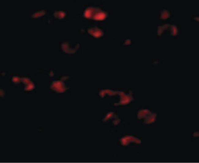 TMEM18 Antibody - Immunofluorescence of TMEM18 in Mouse Brain cells with TMEM18 antibody at 20 ug/ml.
