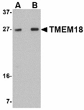 TMEM18 Antibody - Western blot of TMEM18 in rat brain lysate with TMEM18 antibody at (A) 0.5 and (B) 1 ug/ml.