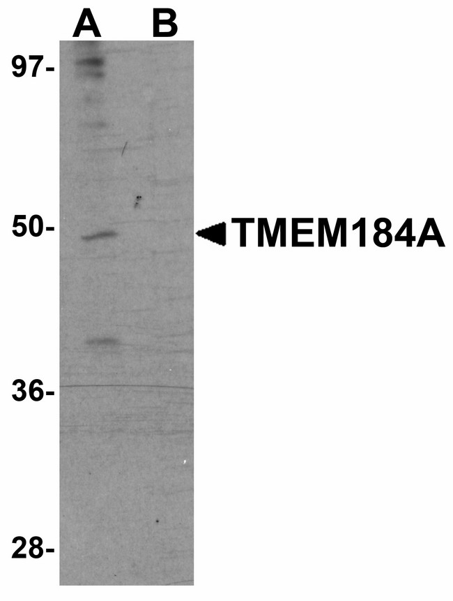 TMEM184A Antibody - Western blot of TMEM184A in human placenta lysate with TMEM184A antibody at 1 ug/ml in (A) the absence and (B) the presence of blocking peptide.