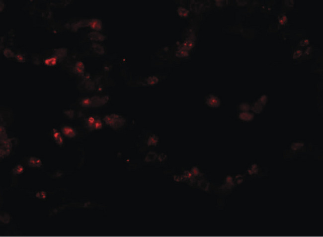 TMEM184B Antibody - Immunofluorescence of TMEM184B in human lung tissue with TMEM184B antibody at 20 ug/ml.